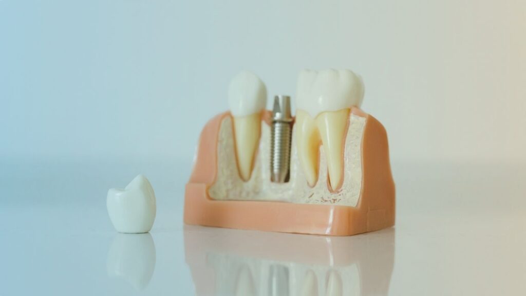 اسباب اصفرار الاسنان و أهم طرق علاج اصفرار الاسنان 2023